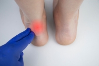 Understanding the Achilles Tendon